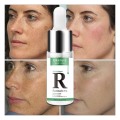 Anti-wrinkle Extract Acne Removal Scars Treatment Massage Oil For Any Skin Care Natural Tea Tree Essential Oil