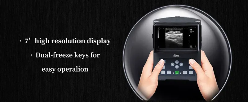 Veterinary Ultrasound Scanning Machine Bw590V