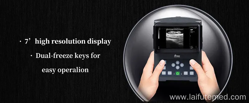 Veterinary Ultrasound Scanning Machine Bw590V