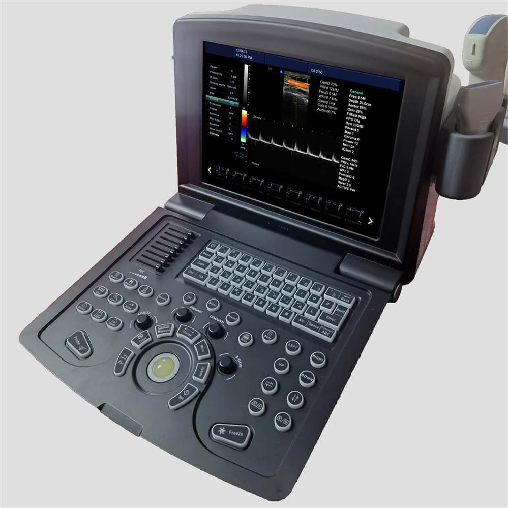 Tragbare Farbdoppler -Ultraschallmaschine