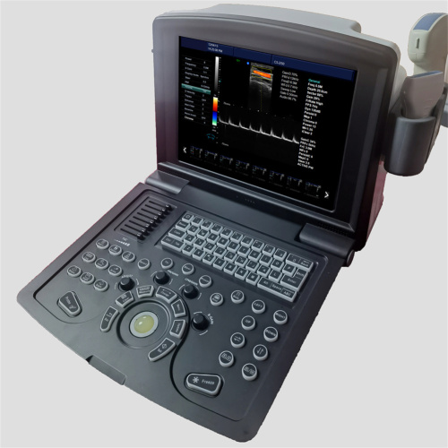 Portable Ultrasound Scanner Portable Color Doppler Ultrasound Scanner for Sale Manufactory