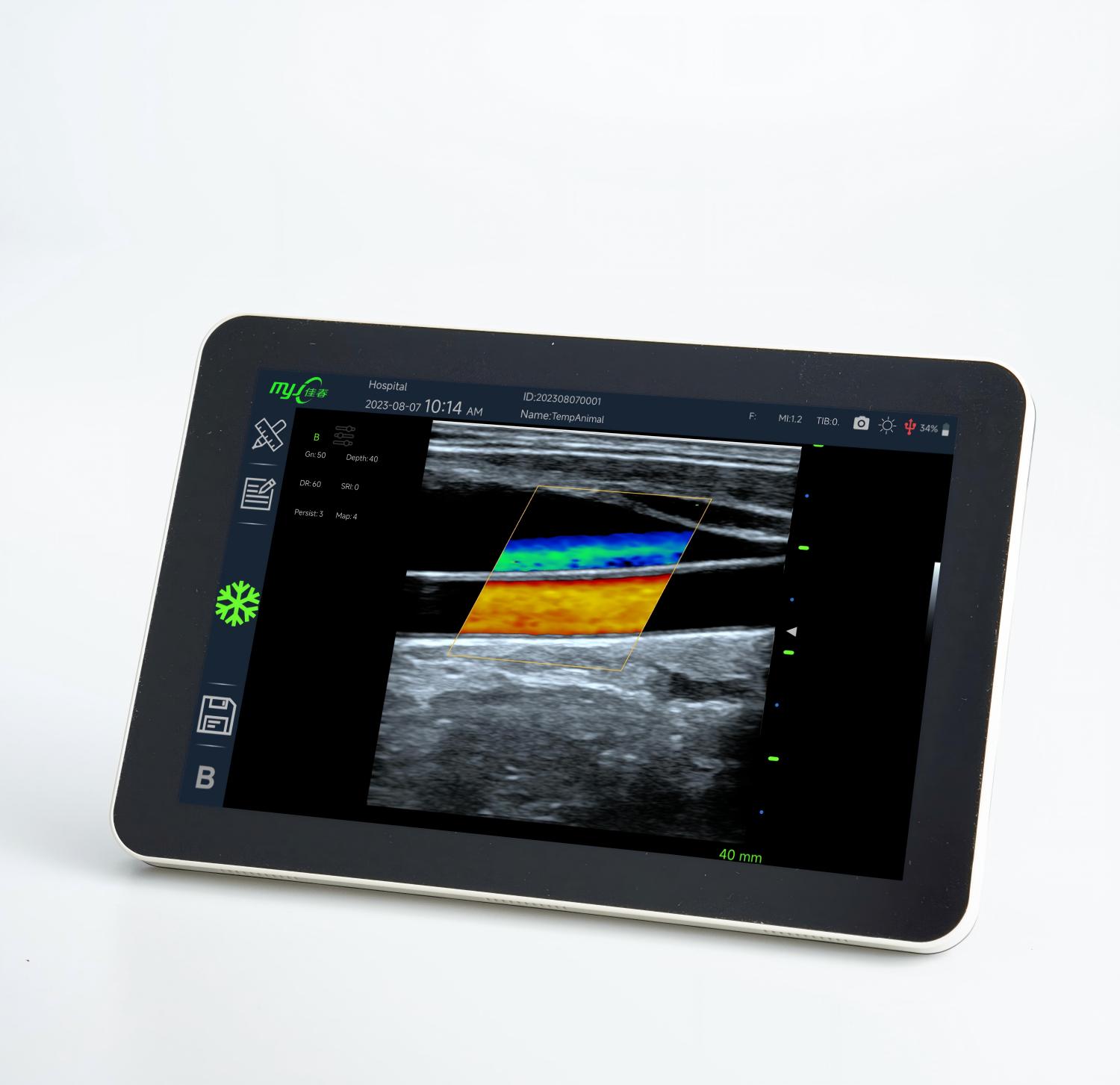cheap ultrasound machine for sale