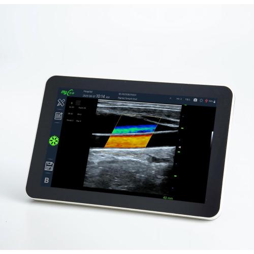 FastScan OPU veterinary ultrasound machine for sale