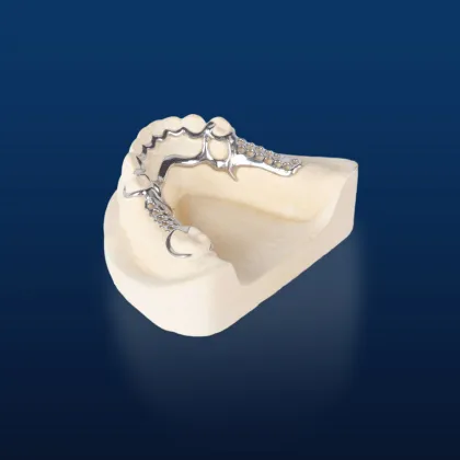 Bego Metal Partial Denture