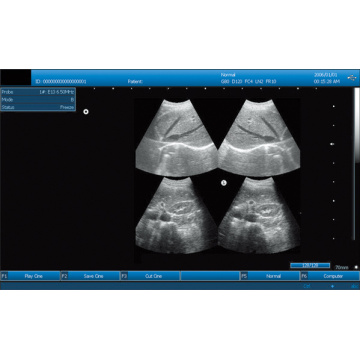 SS-100 Portable Ultrasound Probe