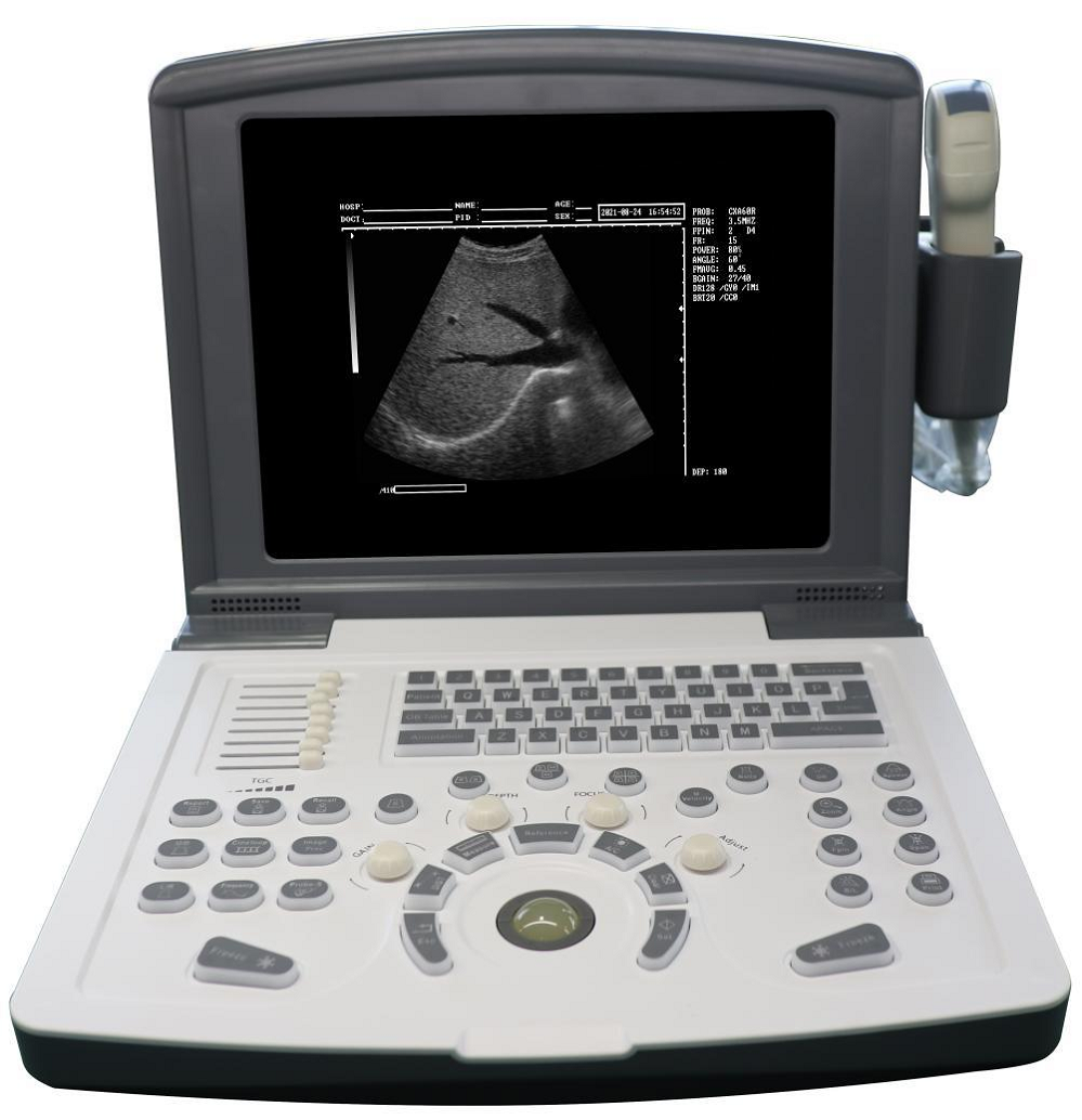 Portable black and white Diagnostic Ultrasound scanner