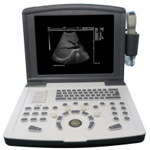 Portable black and white Diagnostic Ultrasound scanner