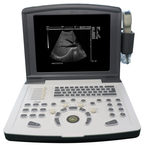 Scanner de ultrassom portátil em preto e branco
