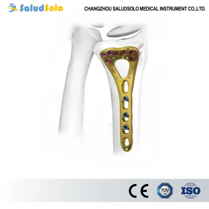VA Distal Radius Locking Plate