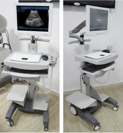 Trolley type ultrasound machine for clinic
