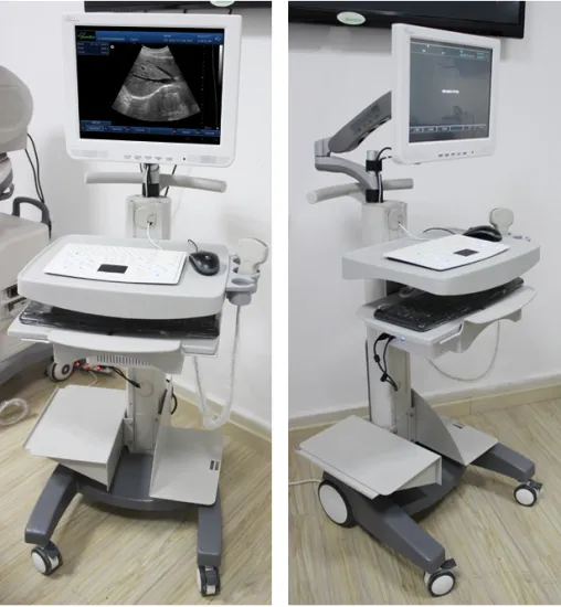 Trolley type ultrasound machine for clinic