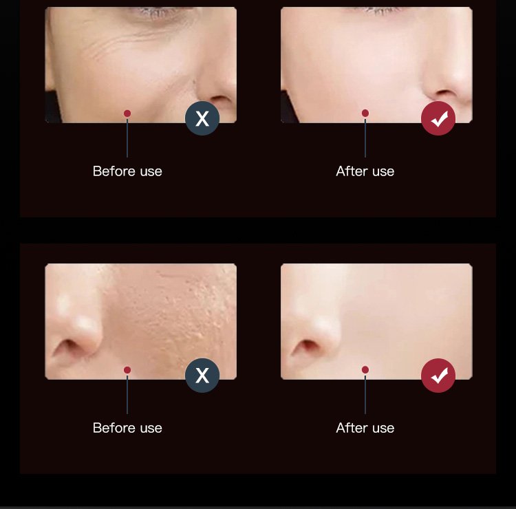 light therapy face mask