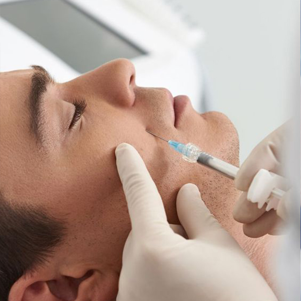 Microneedling de preenchimento dérmico para anti -envelhecimento