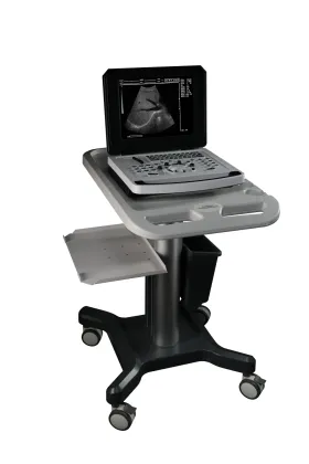 Notebook Color Doppler Ultrasound Scanner Machine