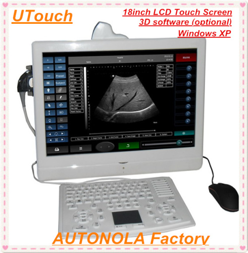 3D Software Full Digital B Model Ultrasound Scanner with PC Platform