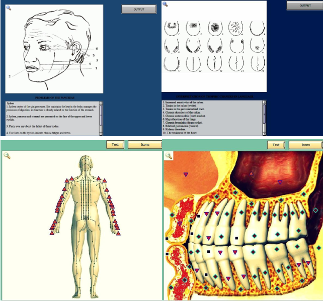 innovative bio-resonator 3d nls quantum body health analyzer