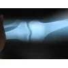 hot sex blue film medical dry film medical film x-ray medical film
