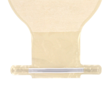 Disposable Anorectostomy Open Pocket Fistula Bag