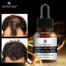 ARTISCARE Hair Oil Hair Keratin Growth Essence Product Hair Care Essential Oil Liquid Treatment Preventing Hair Loss Coconut oil