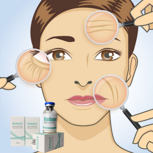 Facial Fillers Fill Temple Cheek Volume