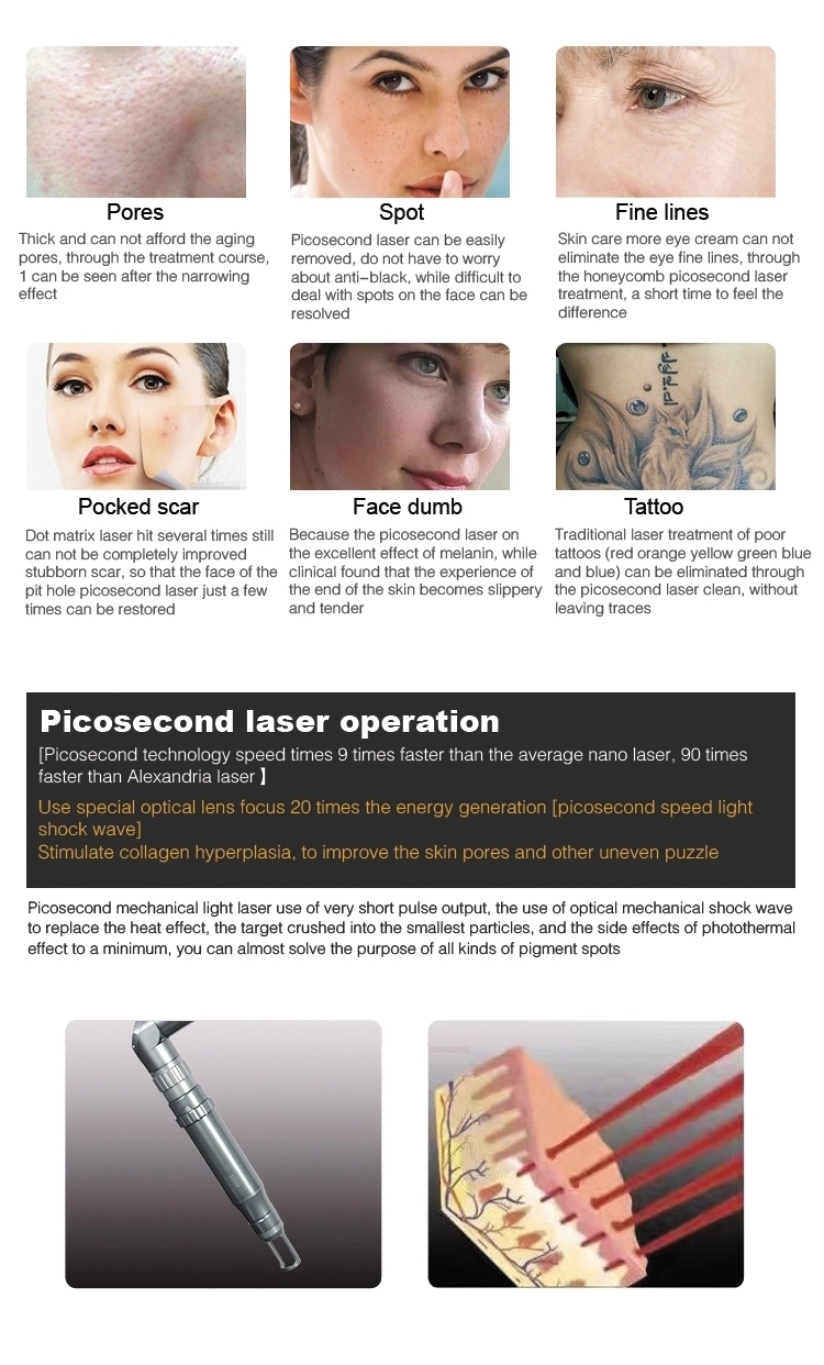 q switch laser machine