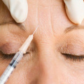 Microneedling Dermal Filler for Anti Aging