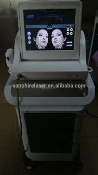 ultrasound lifting hifu/hifu face lifting equipment