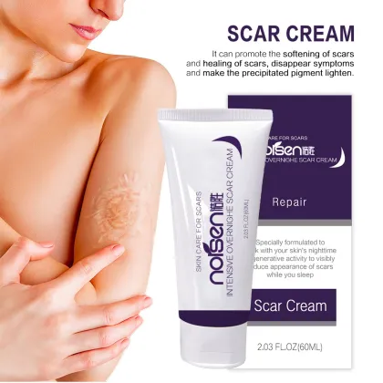Best Wholesale Scar and Stretch Mark Removal Cream