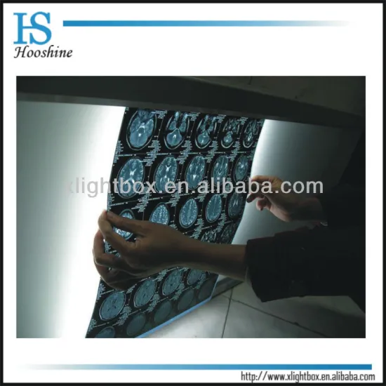 medical X-ray film viewer/reader