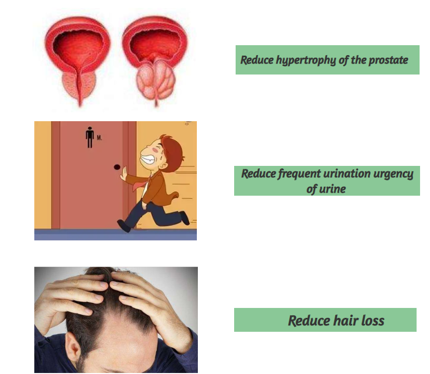 Palmetto Extract Powder Prevent Prostatitis