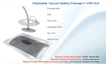 Vacuum Sealing Drainage (I-VSD) Suit