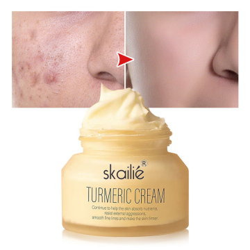Private Label Turmeric Facial Cream for Whitening and Dark Spot Removal