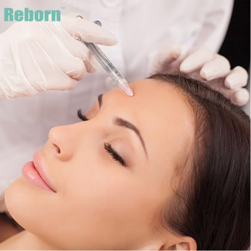 Reborn PLLA Dermal Fillers Treatment