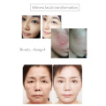 Máquina facial de electroporación de microcorriente portátil Omeina