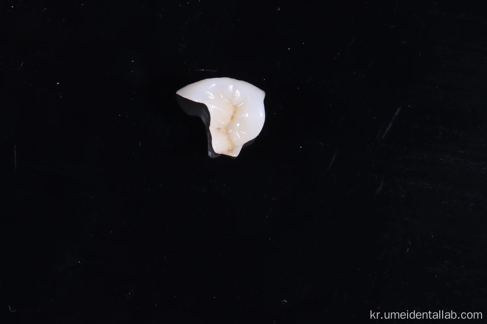 Dental Restoration Close-up