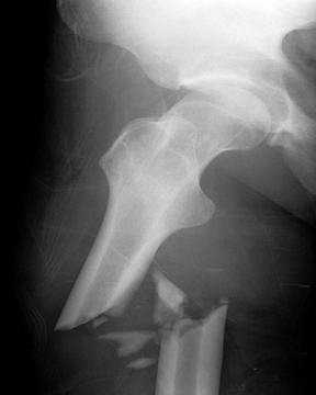 medical dry film,CR film,x ray film,CT film,fuji film