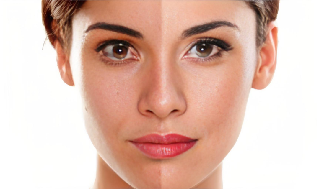 skin beauty