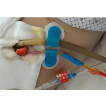 3*9cm Catheter Stabilization Device with Foam Anchor Pad (Single/Double Tube)