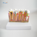Συνδυασμένο μοντέλο κοινών οδοντικών ασθενειών