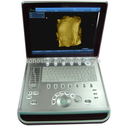 Sonostar Ultrasonic Diagnostic Devices Digital Portable Ultrasound Machine Price SS-9
