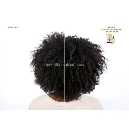 Natural Rosemary Hair Scalp Oil - Organic Scalp Massage Oil for Hair Growth & Anti-Itching (4.2OZ)