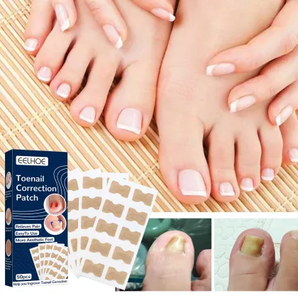 Glue-Free Ingrown Toenail Correction Sticker Patch - Foot Care Treatment