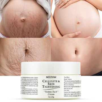 Wholesale Stretch Marks and Scar Removal Cream - Skin Tightening Repair