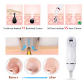 Diamond Microdermabrasion Machine Skin Peeling Vacuum Blackheads Removal Device Scar Acne Clean Instrument Face Care Massage