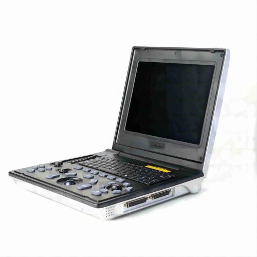 Male fatty liver ultrasound diagnostic instrument