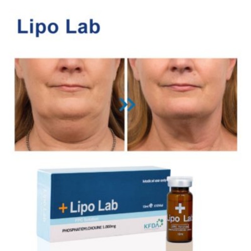 Ampoule congelando el labio de lipo grasa disolvente lipolítico