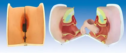 Contraceptive Guidance Model