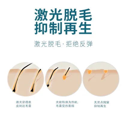 Skin Rejuvenation Hair Light Removal Device At Home