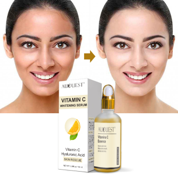 Private Label Organic Vitamin C Serum - Whitening & Dark Spot Corrector