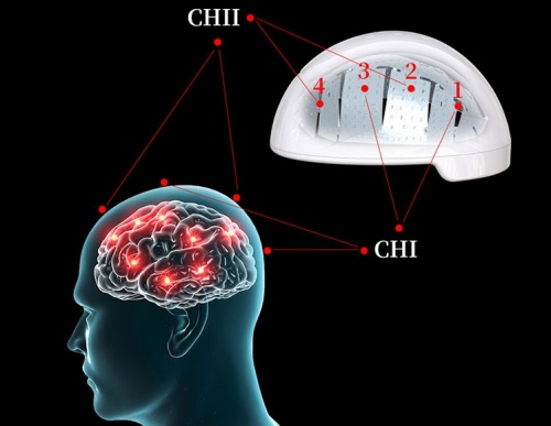 Hjärnterapeutisk hjälm för kraniocerebral skada